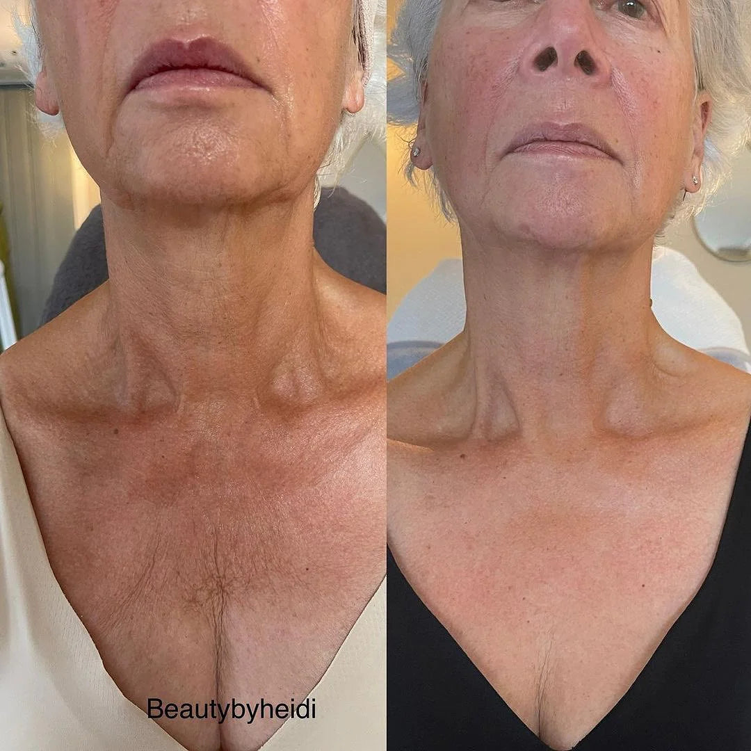 KRX Aesthetics NECK LIFT KRĒMS KAKLA ZONAI, 50 g